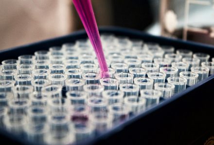 Laboratory research equipment illustrating Abu Dhabi’s investment in biotechnology and longevity